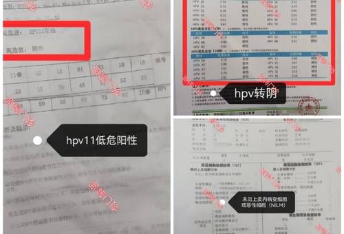 膝盖上中了一箭会留后遗症吗 专家解答常见疑问